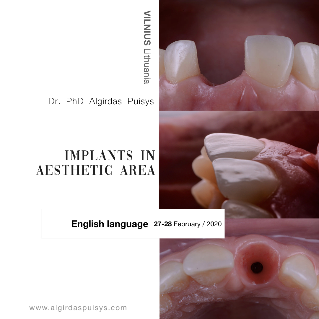 Implants in Aesthetic area 27 28 February