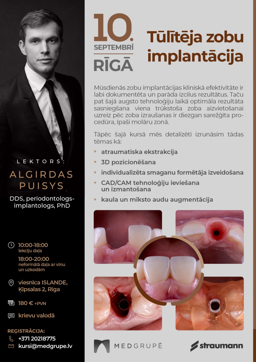 Immediate implantation Algirdas